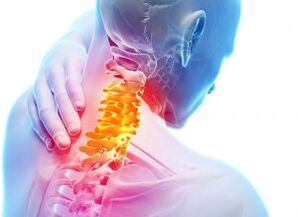Sāpes un patversmes dzemdes kakla zonā ar trešo osteohondrozes pakāpi